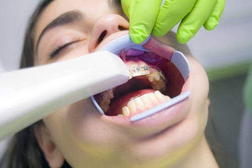 tratamiento-ortodoncia-correcto-2