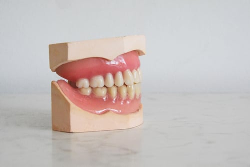 dientes-chuecos-1
