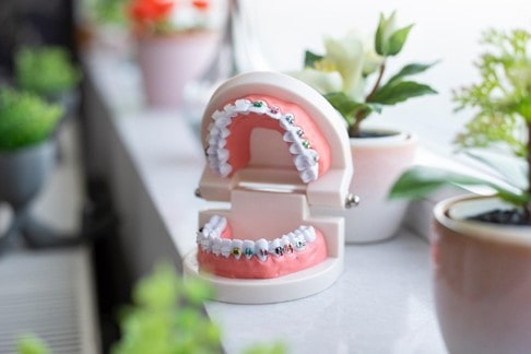 el-antes-despues-de-un-tratamiento-de-ortodoncia-dientes