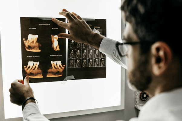 ¿Es necesario extraer dientes en un tratamiento de ortodoncia?