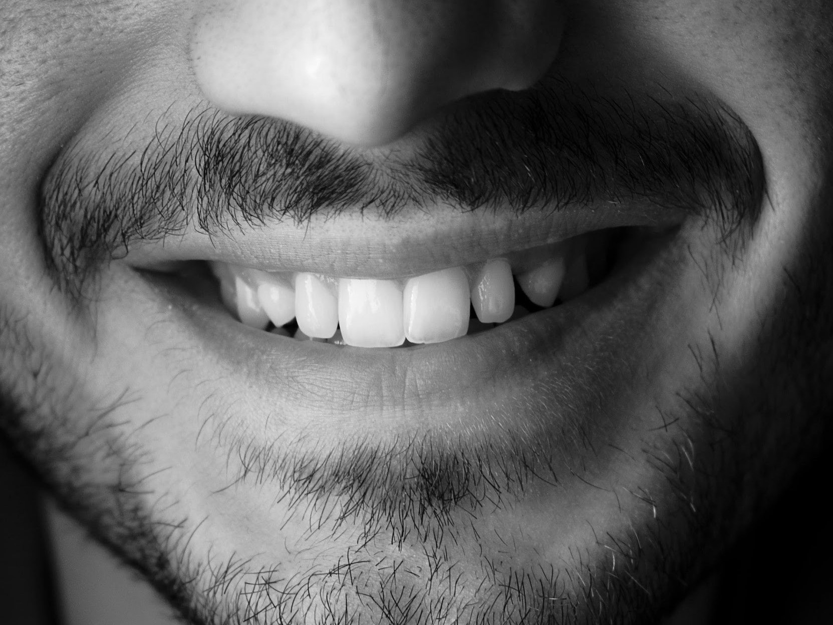 ¿Cómo arreglar mis dientes sin brackets? Conoce los Alineadores